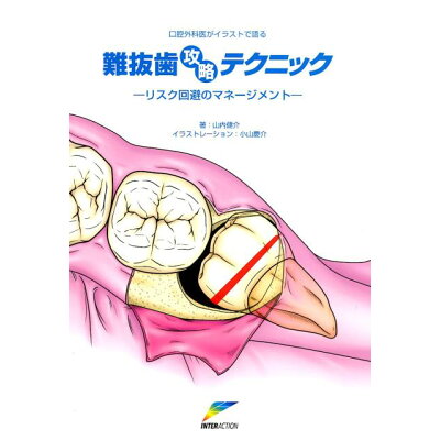 楽天市場 口腔外科医がイラストで語る難抜歯攻略テクニック リスク回避のマネージメント インタ アクション 山内健介 価格比較 商品価格ナビ 楽天市場 口腔外科医がイラストで語る難抜歯攻略テクニック リスク回避のマネージメント インタ アクション 山内健介 価格比較 商品価格ナビ
